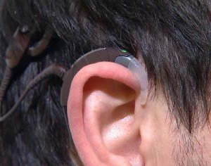 cochlear-upgrade-6pkg-transfer
